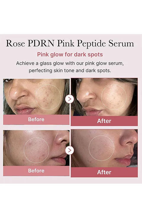 [medicube] PDRN Pink Peptide Serum(30ML/1.01fl.oz)